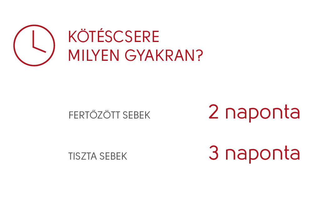 kötéscsere